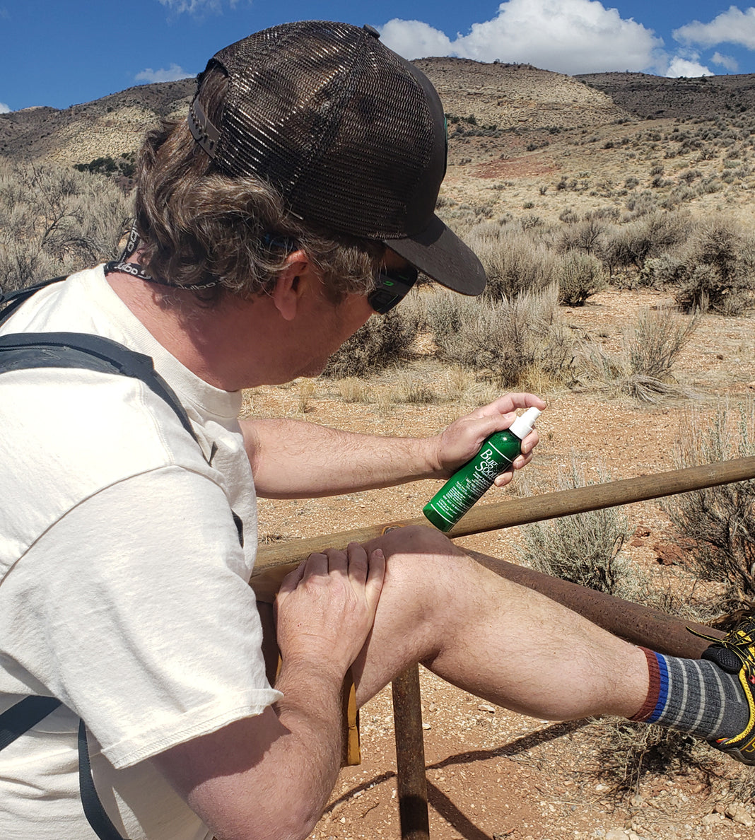 How to Avoid Bug Bites While Camping: 5 Easy Tips